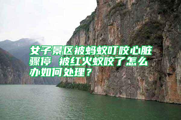 女子景區(qū)被螞蟻叮咬心臟驟停 被紅火蟻咬了怎么辦如何處理?